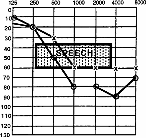 audiogram graph